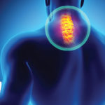 Cervical Facet Radiofrequency Neurotomy