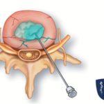 Discography Discography