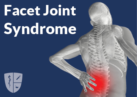 Facet Joint Syndrome