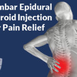 Lumbar Epidural Steroid Injection Lumbar Epidural Steroid Injection