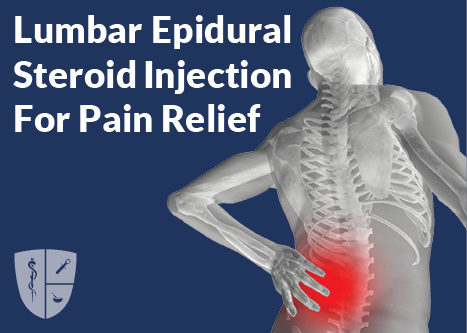 Lumbar Epidural Steroid Injection