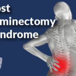 Post Laminectomy Syndrome Post Laminectomy Syndrome