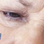 Tension Headaches Tension Headaches