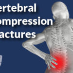Vertebral Compression Fractures